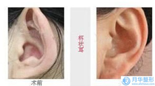 信陽(yáng)向新生美容診所桃膠豐胸手術(shù)比較便宜