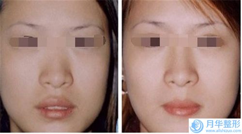 深圳盛美佳醫(yī)療美容門診部鼻背矯正怎么樣門診部實力解讀