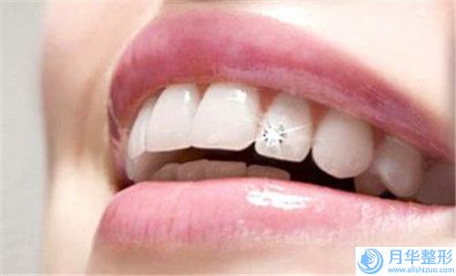 南昌市去脂肪粒價(jià)目表新版預(yù)覽(近6個(gè)月均價(jià)為：2160元)
