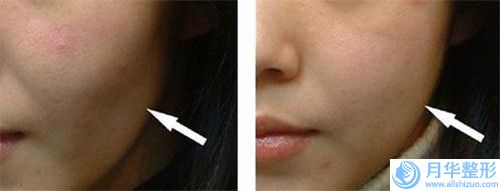 蘇州3d仿繡眉美容價(jià)格,蘇州3d仿繡眉的費(fèi)用大概多少錢(qián)啊
