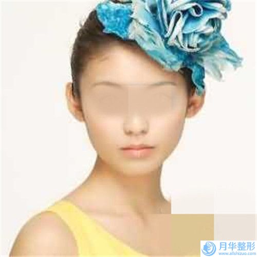 永州豐韻豐胸手術(shù)的價(jià)格是多少效果可以維持多久