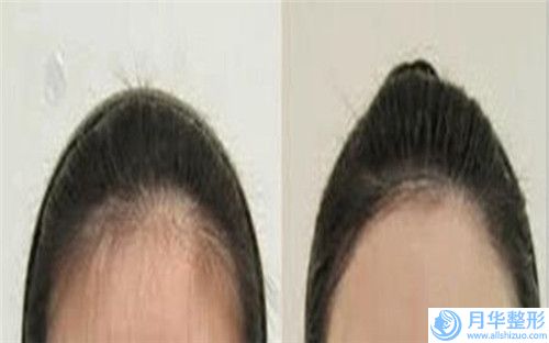 中國提升面部醫(yī)院推薦：提升面部醫(yī)院前50強值得推薦