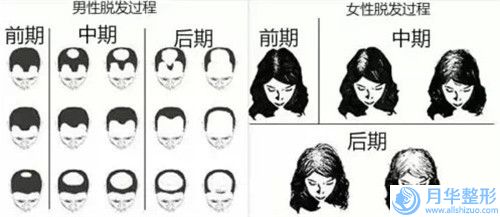 黑臉娃娃縮小毛孔副作用大不大