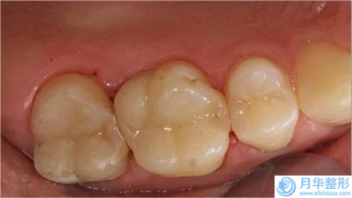 廖文英整形醫(yī)生腰腹吸脂手術(shù)水平怎么樣個(gè)人資料手術(shù)實(shí)力特點(diǎn)腰腹吸脂手術(shù)反饋