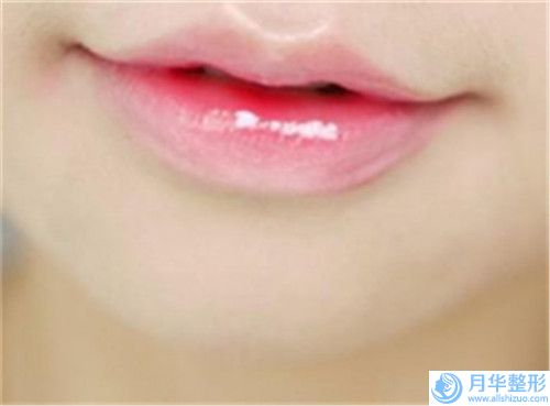 信陽(yáng)市下巴豐價(jià)格(價(jià)目)官方公開(kāi)曝光(下巴豐均價(jià)為：25065元）