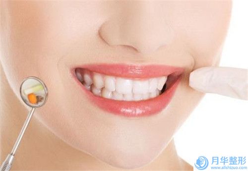 衢州大腿吸脂減肥需要費用多少