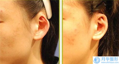 蘇州美博士整形美容門診部是否具備隆胸假體進(jìn)口手術(shù)資質(zhì)