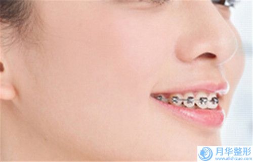 長春美佳******整形美容門診部臀部抽脂塑性技術(shù)引領(lǐng)潮流