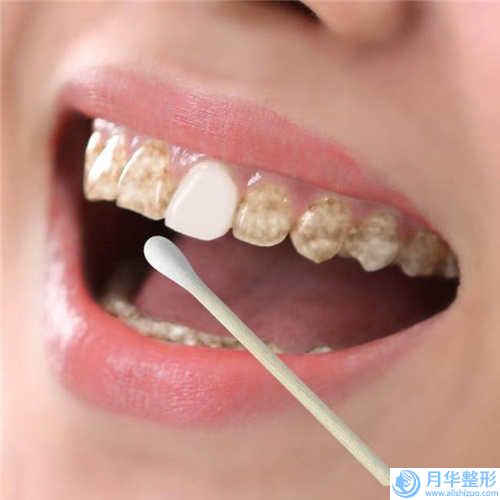 德宏射頻溶脂瘦后背手術(shù)價(jià)格與哪些因素有關(guān)