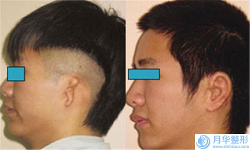 國內(nèi)取注射豐胸醫(yī)院推薦：取注射豐胸醫(yī)院前50強(qiáng)實(shí)力評測