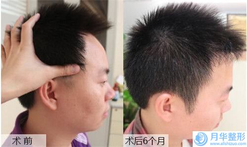 大安瑞鑫醫(yī)療美容整形價(jià)格表詳盡曝出-臉上激光祛斑案例