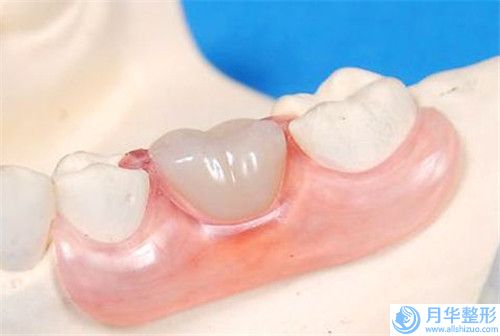 菏澤市冷凍溶脂手臂價(jià)位表瀏覽(近6個(gè)月均價(jià)為：10522元)