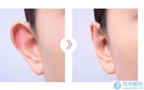 隆胸修復手術整三甲醫(yī)院推薦：隆胸修復手術醫(yī)院top30強挨個點評