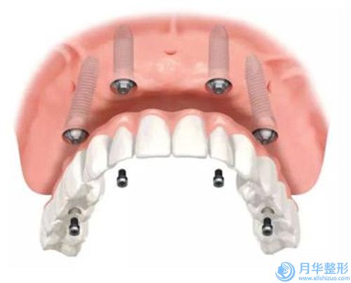 六盤水水動力吸脂瘦大腿費用是多少與什么有關(guān)呢