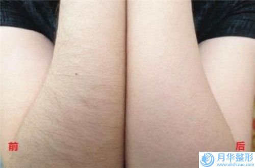 李子奇醫(yī)生臉上做水光針案例-價(jià)格表(費(fèi)用)2024年