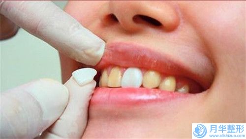 重慶美腰腹部吸脂術到底安不安全