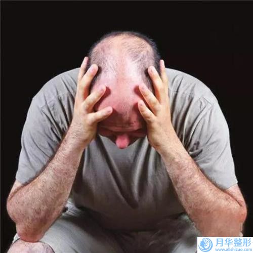廣安市快速瘦臉價(jià)目表口碑全新一覽-廣安市快速瘦臉價(jià)格及術(shù)后護(hù)理方式