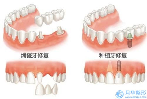 襄陽市吸脂嘴角收費標準都不貴-襄陽市中心醫(yī)院(湖北文理學院附屬醫(yī)院)整形科價格(費用)清單