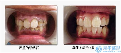 滕州韓美醫(yī)療整形診所價(jià)格(收費(fèi)標(biāo)準(zhǔn))2024優(yōu)惠來襲-抽腹脂肪手術(shù)案例