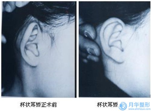 天津市隆胸抽脂手術(shù)價格表新鮮大出爐啦(隆胸抽脂手術(shù)大概多少錢左右)