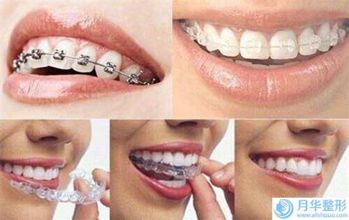 高新靜欣醫(yī)療美容單自體脂肪填充費用大概多少錢呀