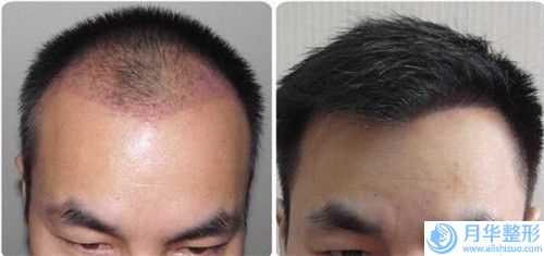 北京芙艾醫(yī)療整形美容門診部注射瘦臉手術(shù)整形費用大概需要多少