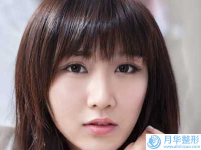 榆林市中醫(yī)醫(yī)院皮膚美容與燒傷整形科價格收費表項目表-迷你小拉皮手術(shù)案例