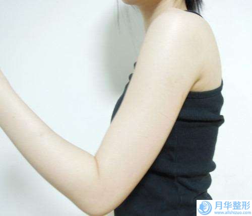 衡水市拔牙左側(cè)下頜智齒醫(yī)生排行榜前10排名表2024新版-衡水市拔牙左側(cè)下頜智齒口腔醫(yī)生