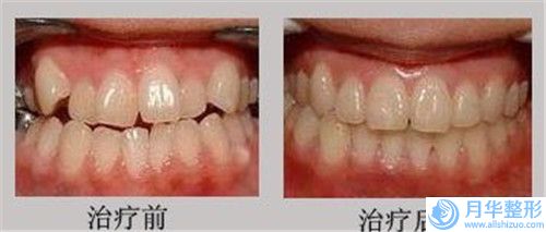 淄博市知名肥瘦腰機構(gòu)-淄博市肥瘦腰醫(yī)院排行榜任你挑
