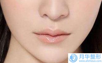 舟山王志軍醫(yī)療美容下巴手術(shù)墊怎么樣口碑簡(jiǎn)介