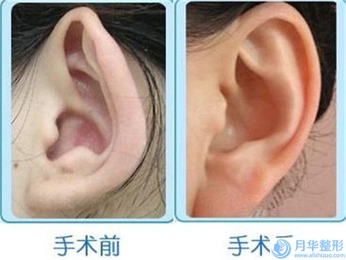 宿城區(qū)天黛醫(yī)學(xué)美容門診部隆胸修復(fù)費(fèi)用具體多少