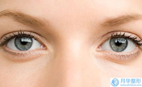 廣州眼皮雙眼皮手術(shù)的費(fèi)用是多少呢