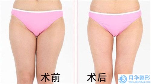 天津醫(yī)科大學口腔醫(yī)院（口腔黏膜科）口腔美容科價格表公開-骨源性牙齒外突4969-7421元