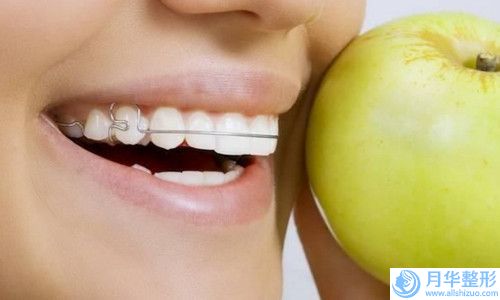 腰腹部溶脂手術(shù)的價(jià)位是大概多少