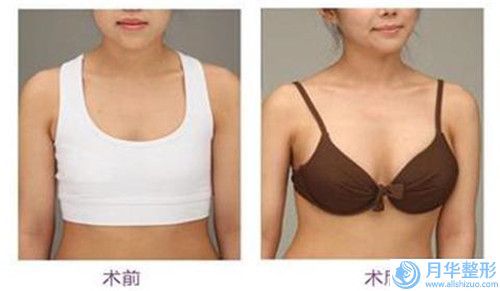 雞西市鐵路地區(qū)中心醫(yī)院整形外科整形價(jià)目表詳細(xì)區(qū)間在此-額頭咖啡斑去除案例
