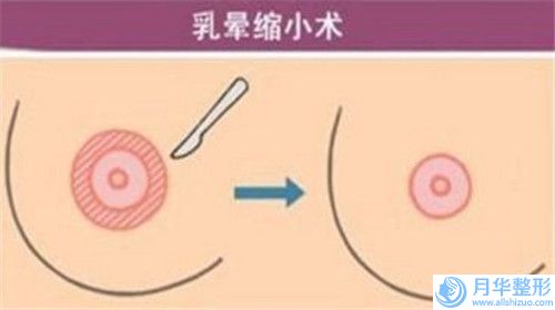 2024年蕪湖市自體豐額頭整形醫(yī)院上榜清單前十佳參考