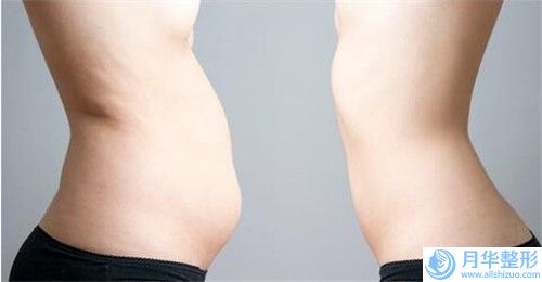 顴骨降低整形有即刻效果嗎「顴骨降低整形整形手術(shù)的效果通常能夠保持幾年的時(shí)間」