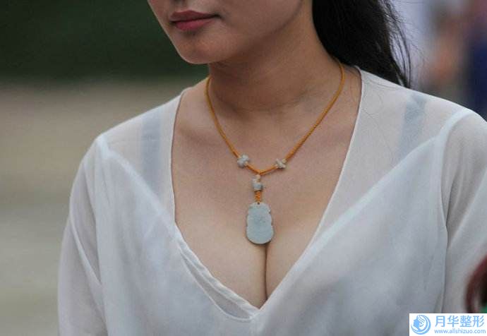 陽泉膨體豐額頭整形美容適應(yīng)人群與禁忌人群
