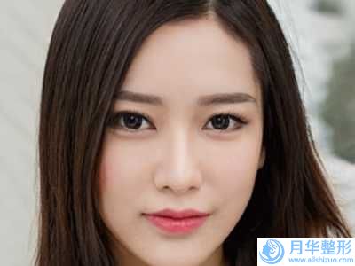 眼袋失敗手術修復后果會怎么樣