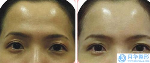 國內(nèi)唇腭裂成人修復(fù)比較好的醫(yī)生：唇腭裂成人修復(fù)醫(yī)生前50新出爐