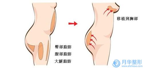 東興品尚醫(yī)療美容門診部價目表醫(yī)生介紹_參考-額頭整形案例