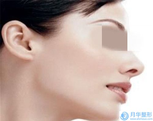 荊州乳房切除再造術(shù)手術(shù)的效果是否是長(zhǎng)久的呢