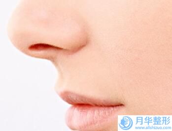 桂林美麗焦點整形醫(yī)院整形價目表性價比公布-太陽穴凹陷自體填充案例