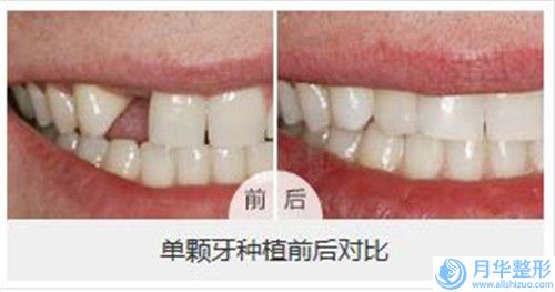 眉山市超聲溶脂減肥瘦身費用表明細曝光-近8個月均價為4709元