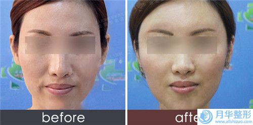 滄州3d紋眉跟霧眉術(shù)價格的影響因素是什么