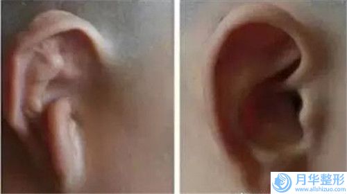 白筱慶整形醫(yī)生胸部縮水隆胸水平怎么樣做得好嗎醫(yī)生口碑技術(shù)實(shí)力案例