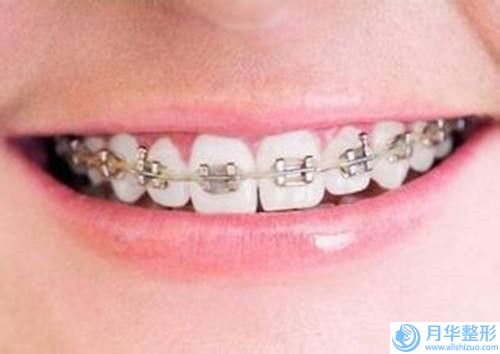水動(dòng)力吸脂瘦腰腹術(shù)維持時(shí)間長(zhǎng)不長(zhǎng)