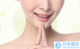 微整下巴玻尿酸三甲醫(yī)院推薦：微整下巴玻尿酸醫(yī)院top30都是哪里