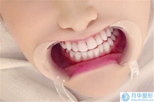 全國(guó)腰腹部抽脂醫(yī)院推薦：腰腹部抽脂醫(yī)院前50強(qiáng)匯合