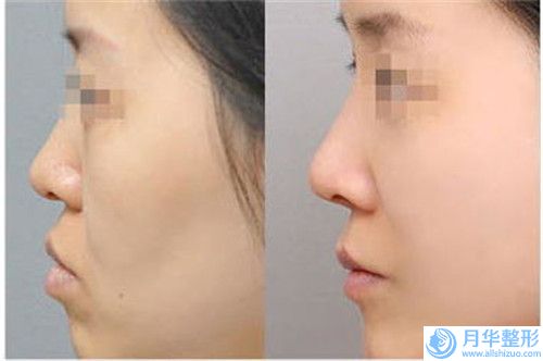哪個(gè)醫(yī)生假睫毛得好云南省-云南省假睫毛專家排行哪個(gè)更正規(guī)